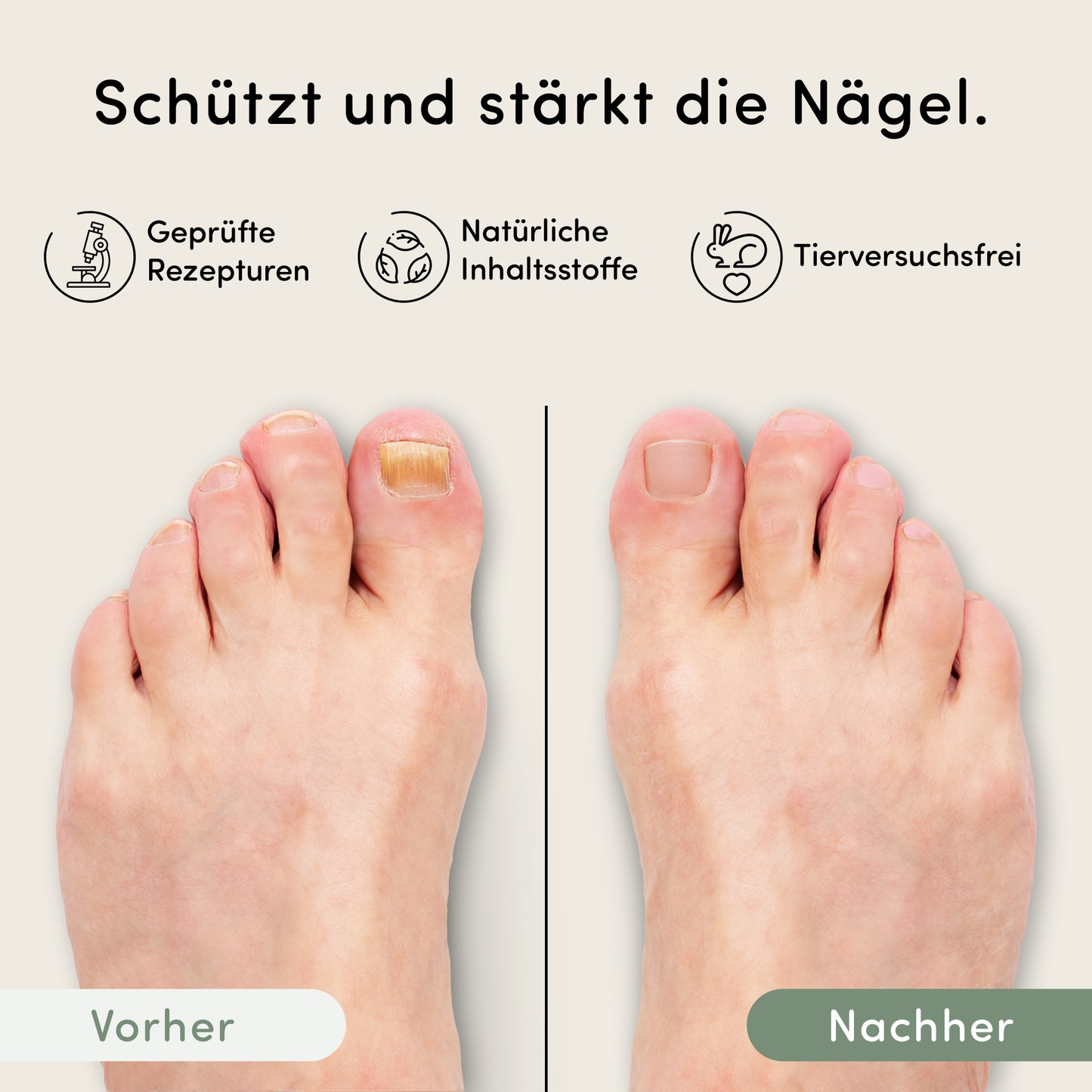 Nagelverzorgingspen